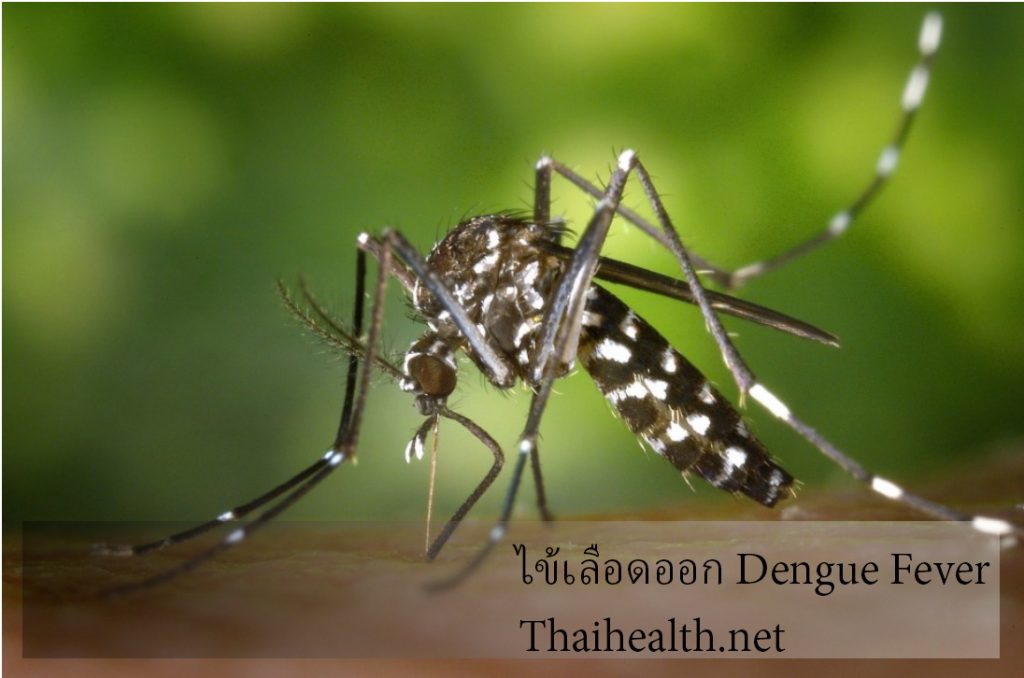 dengue