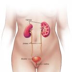 กระเพาะปัสสาวะอักเสบ และปัสสาวะขัด