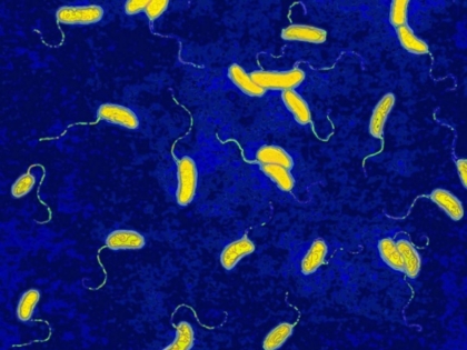 อหิวาตกโรค cholera