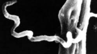spirochete