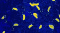 อหิวาตกโรค cholera
